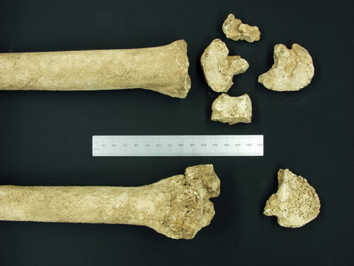Comparison between a normal lower hind leg (top) and that from horse burial c1732 showing spavin condition